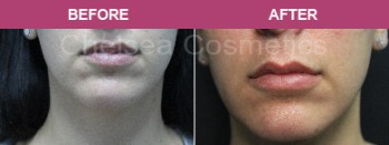 Hire An Expert Cosmetic Specialist in Melbourne - Contact Chelsea Cosmetics Melbourne!