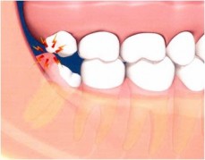 Best Dentist in Airport West | Airport West Dental | Greenvale Dental Group