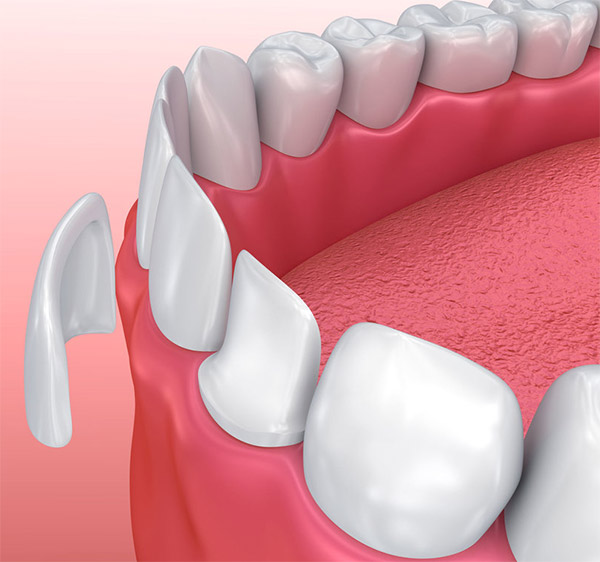 Best Dentist in Airport West | Airport West Dental | Greenvale Dental Group