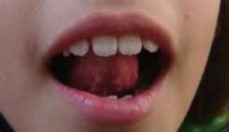 Speech Pathologist For Adults | 0403 970 440