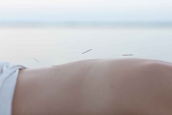 NADJAS FAMILY ACUPUNCTURE