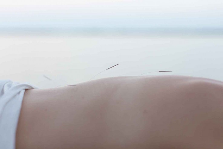 NADJAS FAMILY ACUPUNCTURE