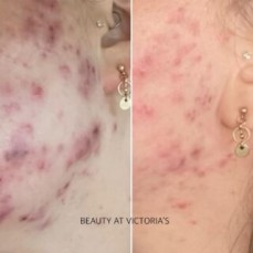 Beauty at Victoria's