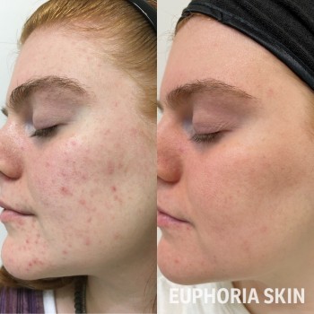 Euphoria Beauty