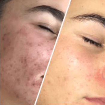 Evoke Medispa