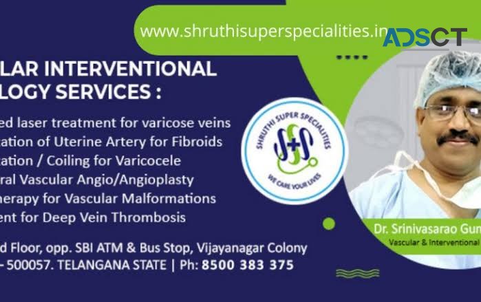 Vascular and Endovascular Surgeon Near Me | Varicose Veins Treatment Cost |  Varicose Veins Laser Tr