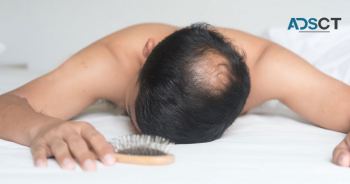 Scalp Massage as Hair Loss Treatment? Know More About it Here...