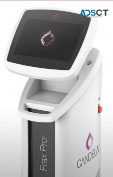 Laser Resurfacing - Frax Pro - Candela Medical Australia