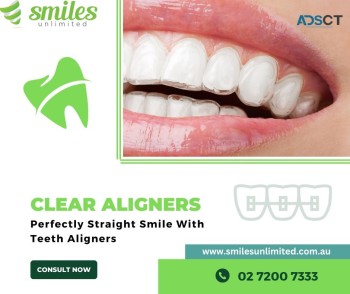 Straighten Teeth With Clear Aligners
