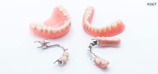 Complete and Partial Dentures in Sydney
