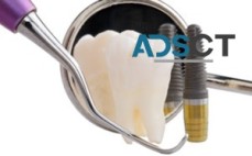 Get High Quality Dental Implants Melbourne 