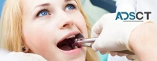 Wisdom Teeth Cost Guide - Dental Costs Australia