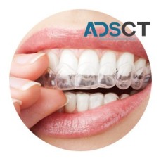 Expert Wisdom Teeth Removal Sydney - Say Goodbye to Dental Pain!