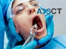 Get Wisdom Teeth Removal Sydney at an Affordable Price