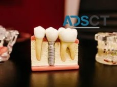 Cheap Dental Implants Australia - Dental Costs Australia