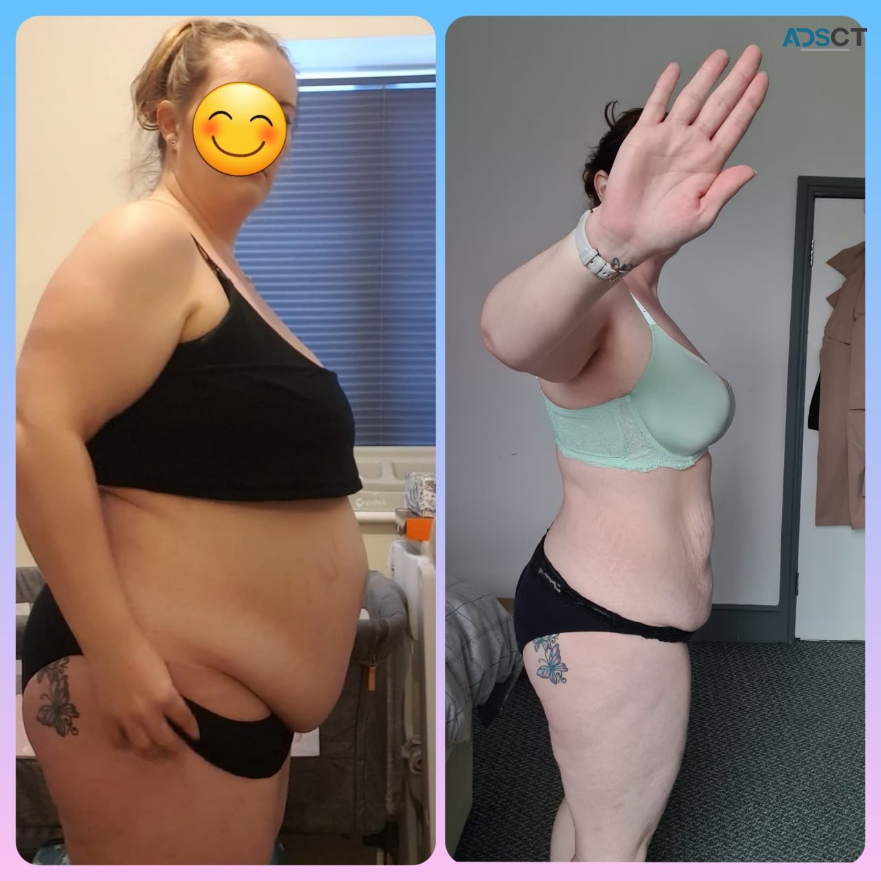 Ozempic,Mounjaro,Wegovy,Saxenda Liraglutide For Sale