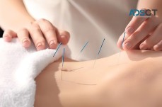 Acupuncture is Used for Treating Pain