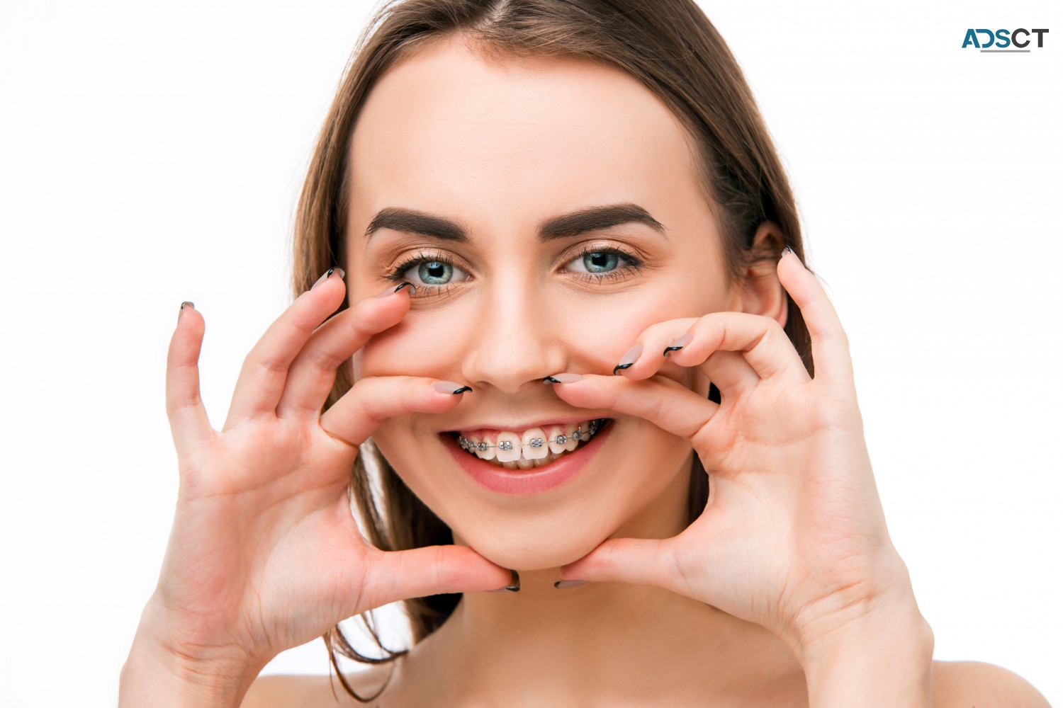 Brace Yourself for a Perfect Smile at Dental Essence in Essendon
