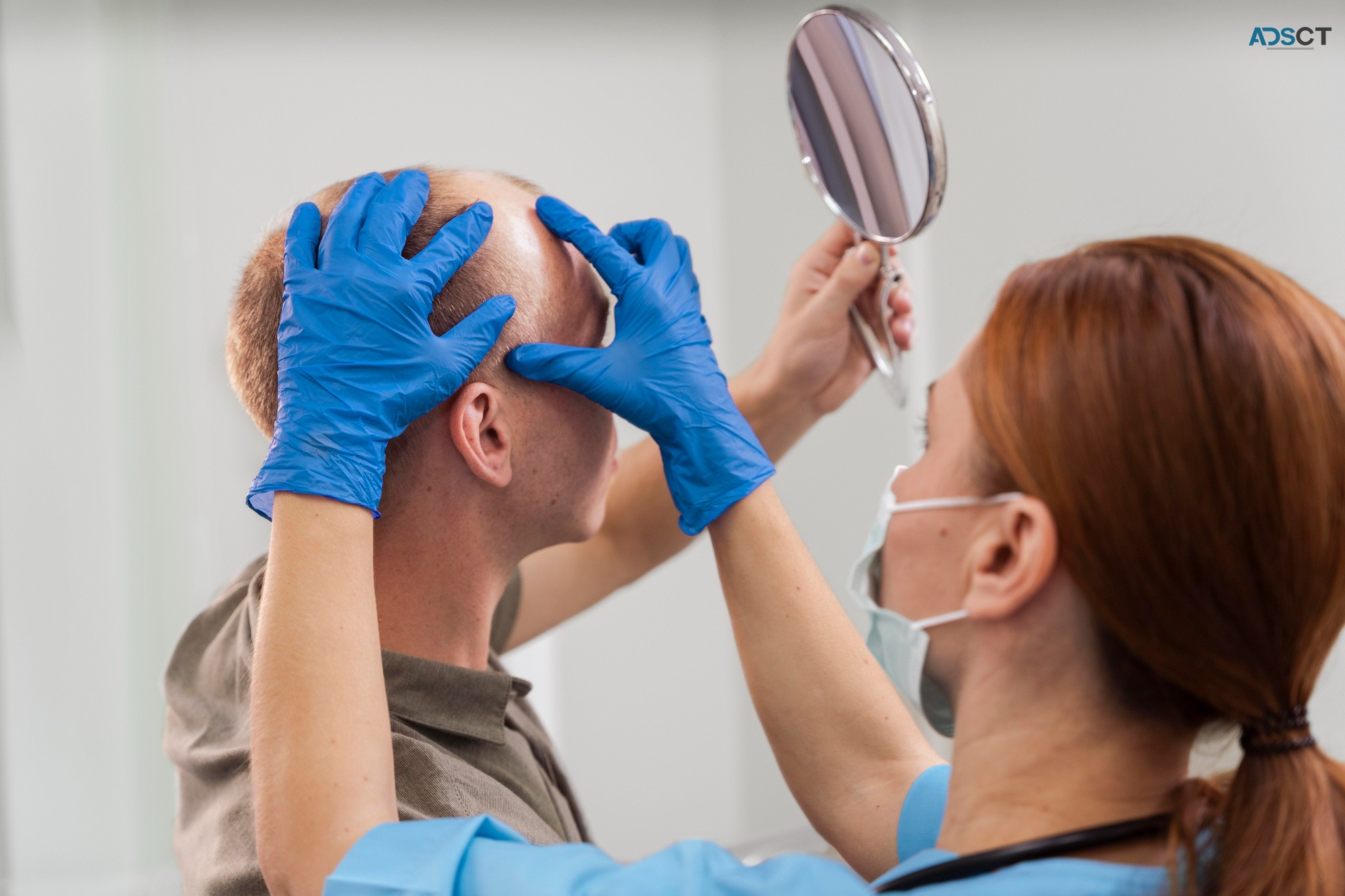FUE Hair Transplant Perth