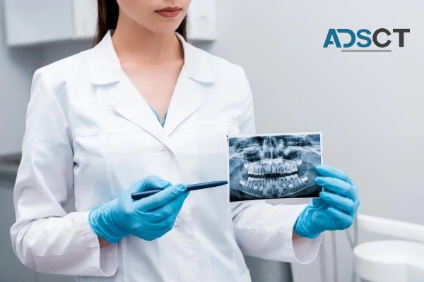 Most Competitive Wisdom Teeth Removal Cost in Sydney