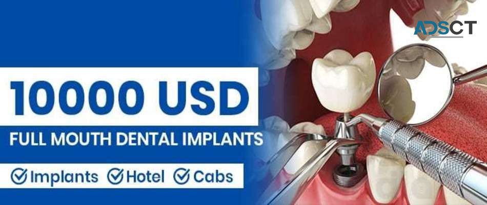 Revolutionizing Smiles with Dental Implants in India - Contact Us 9555887700 