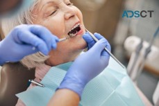 Revitalise Your Smile: Dental Implants in Liverpool for Lasting Confidence