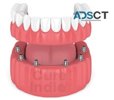 Do you want to know about the cheapest country for dental implants?