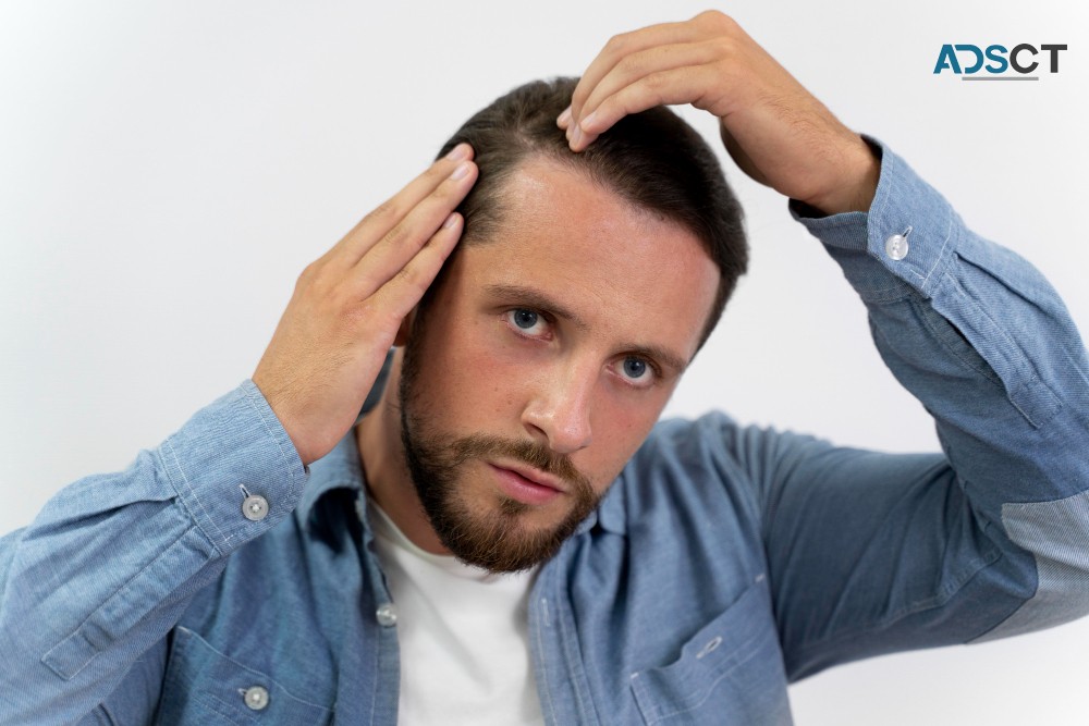 Best Hair Transplant in Brisbane