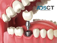 Smile Brighter, Smile Healthier with Dr. Rashid's Dental Care in Gorakhpur