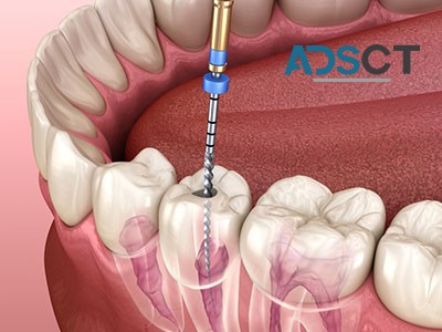 Smile Brighter, Smile Healthier with Dr. Rashid's Dental Care in Gorakhpur