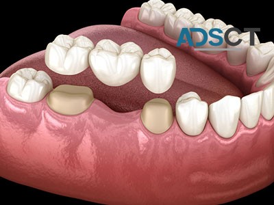 Smile Brighter, Smile Healthier with Dr. Rashid's Dental Care in Gorakhpur