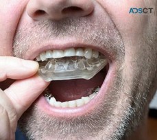 Custom Mouthguards Gosnells by Quick Denture Repair
