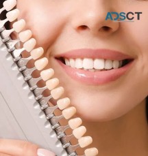 Revitalise Your Smile with Porcelain Veneers Sydney: Premium Crowns for Teeth