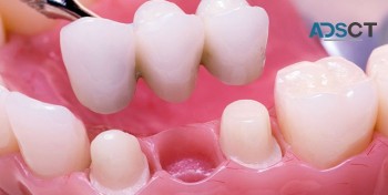 Best Dental Clinic in India