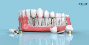 Best Dental Clinic in India