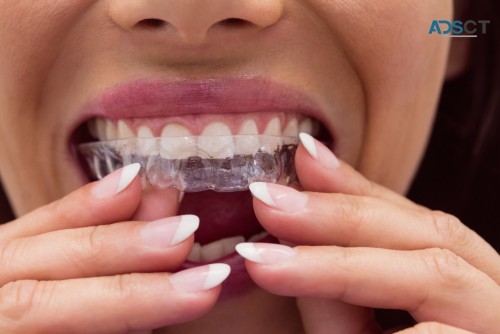 Best Invisible Teeth Braces Cost in India